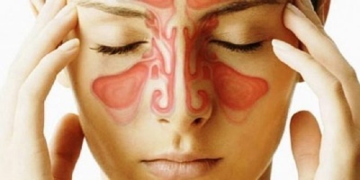 Sinüzit Belirtisi Olabilir