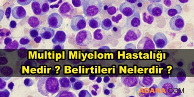 Multipl Miyelom Hastalığı