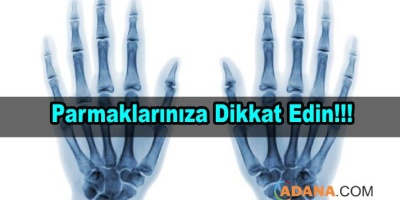 Parmağınızın Kırık Olduğunu nasıl anlarsınız