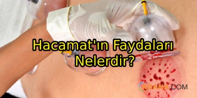 Hacamat'ın Faydaları Nelerdir?