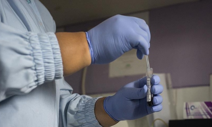 Yeni tedavilerle AIDS'ten ölüm oranı yüzde 40 azaldı