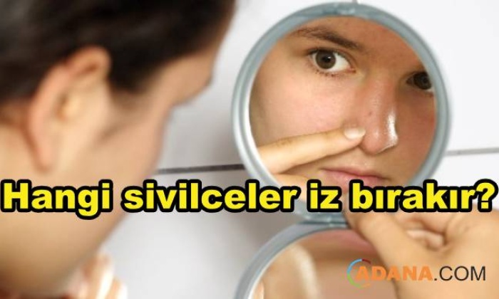 Nasıl Türden Sivilceler İz Bırakır