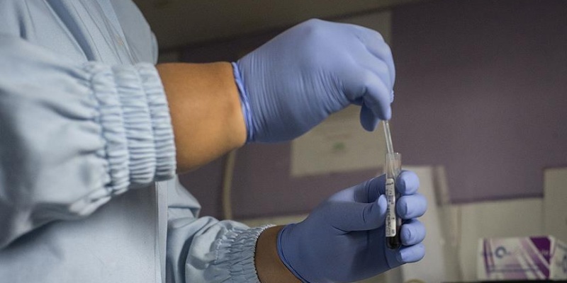 Yeni tedavilerle AIDS'ten ölüm oranı yüzde 40 azaldı