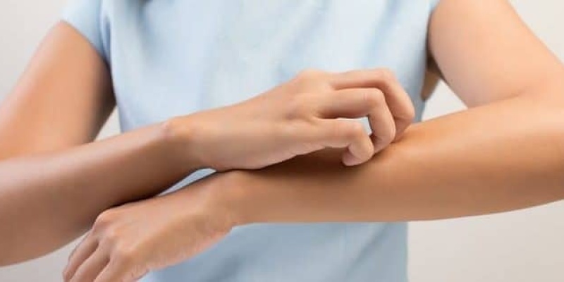 Sebepsiz Kaşıntıya Dikkat !