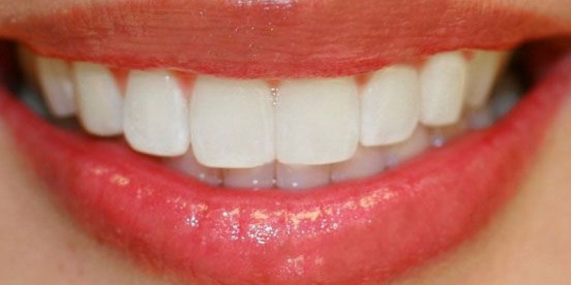 Diş eti problemleri bakın nelere neden olur!