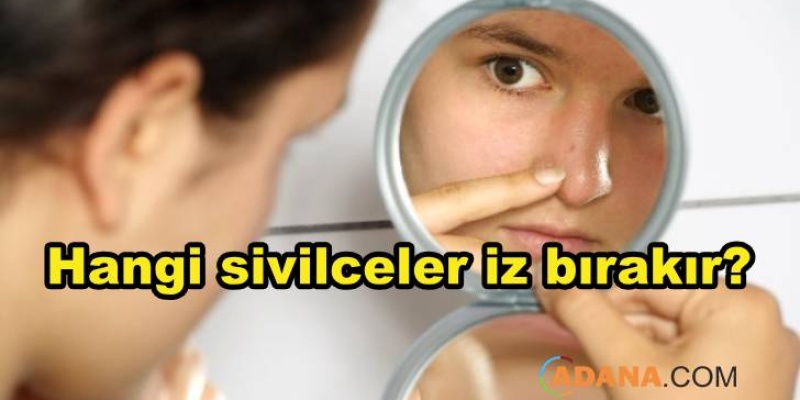 Nasıl Türden Sivilceler İz Bırakır