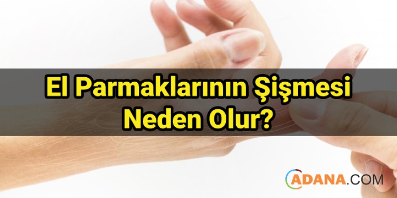 El Parmaklarının Şişmesi Neden Olur?